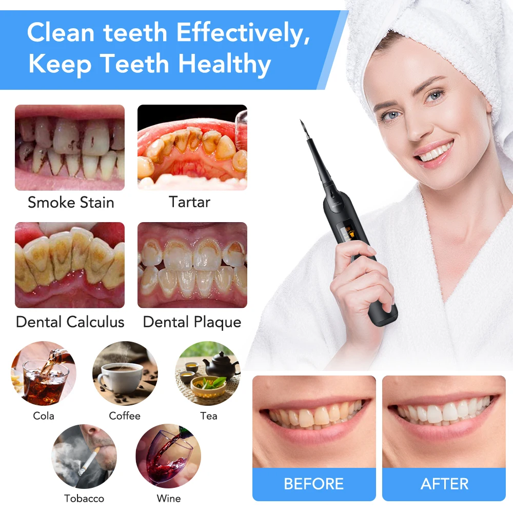 Elektryczny skaler dentystyczn – Teeth Whitening Or Tooth Whitening recenzja i cena