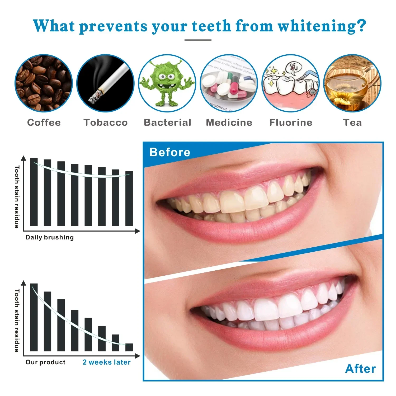 14/28 sztuk 3D paski do wybiel – Whitening Strip 3D recenzja i cena