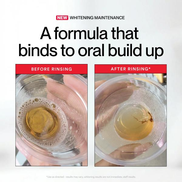 Hismile ID Wybielająca płyn do – Teeth Whitening Products recenzja i cena