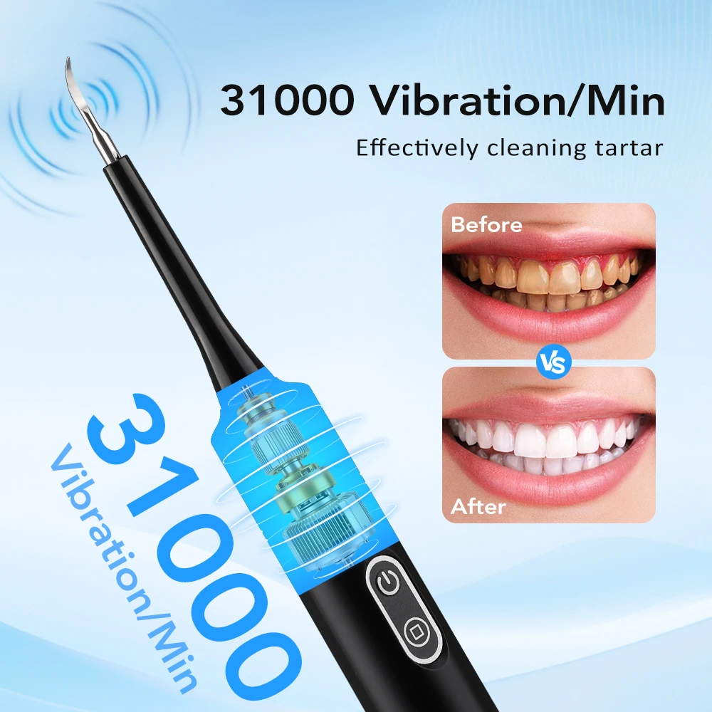 Elektryczny soniczny skaler de – Teeth Whitening Products recenzja i cena